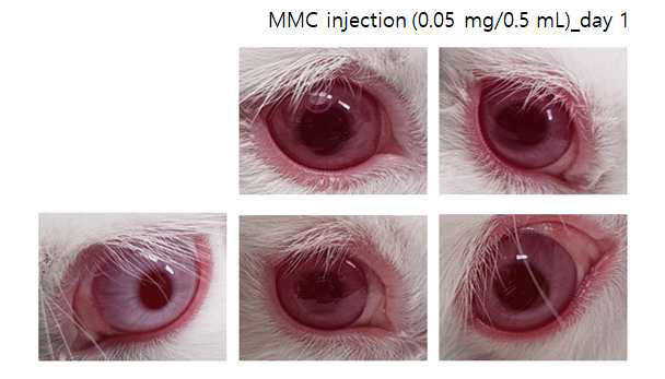 Mitomycine(MMC)를 inject한 토끼의 안구 관찰