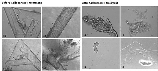 인간 기증 각막 조직에서 분리한 데스메막과 내피세포 복합체 (Before collagenase I) 와 데스메막에서 분리된 내피세포 (After collagenase I)