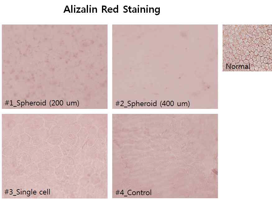 각막내피세포 스페로이드 크기에 따른 각막내피 구조 회복 염색 결과