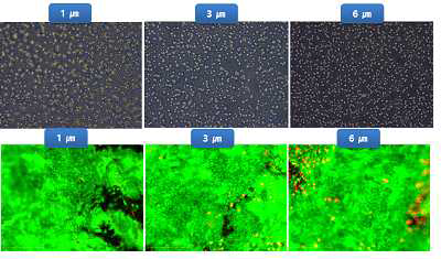 현미경으로 관찰한 PET 멤브레인 표면(위) 및 ARPE-19 세포 배양 7일째에 세포 생존 확인(아래), 살아있는 세포는 그린, 사멸한 세포는 레드 염색
