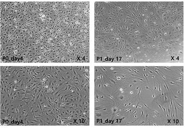 Cornea Keratocyte 배양 passage o day4, passage 1 day17