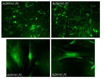 P1, P2에서의 Keratocyte의 marker인 ALDH1A1 발현 확인함