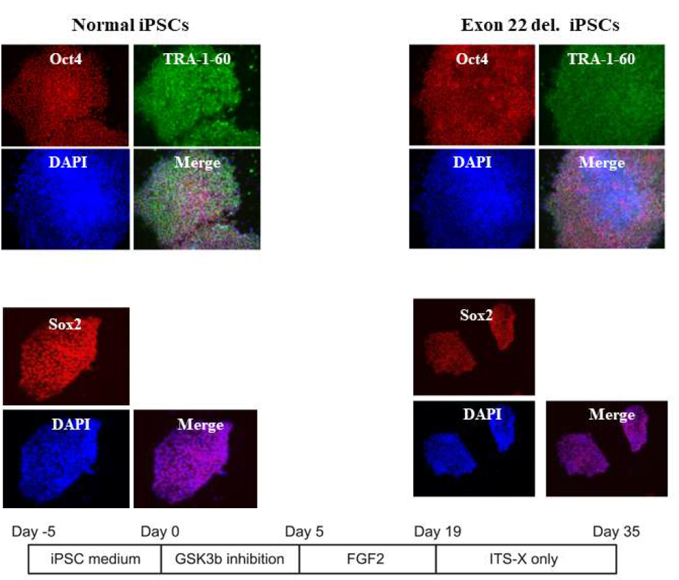 정상 과 Exon 22번이 deletion 된 iPSCs에서 transcription factor 형광염색