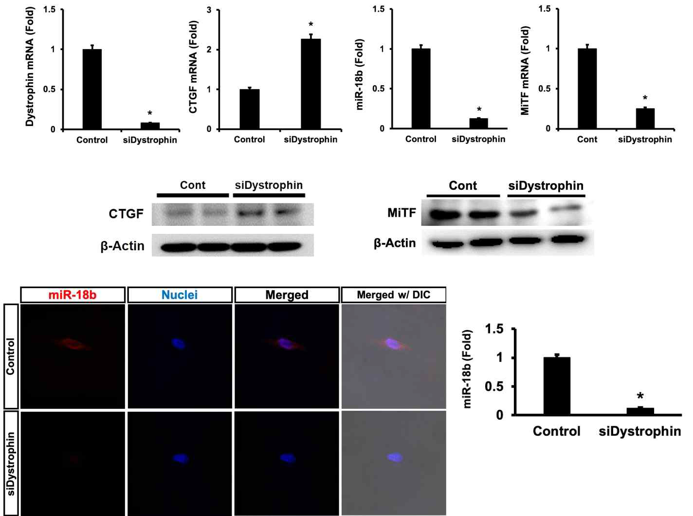 DMD질환 세포모델어서 miR-18b and CTGF의 발현 변화