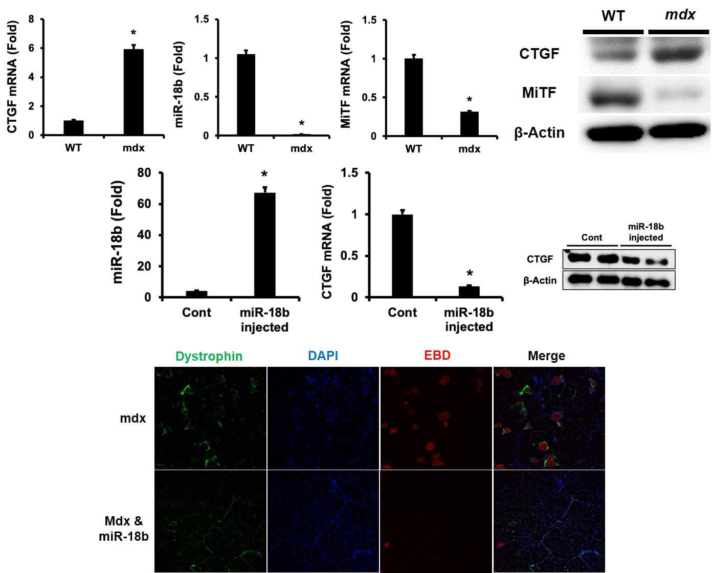 DMD질환 동물모델 (mdx mice)에서의 MiTF, miR-18b and CTGF의 변화