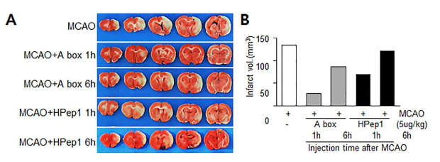 HMGB1 A box 와 hpep1의 뇌경색 억제 효과