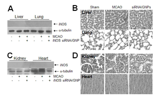 iNOS siRNA를 비강 투여한 후, 12 시간 후에 간, 허파, 신장, 심장에서의 iNOS 억제 효과를 조사