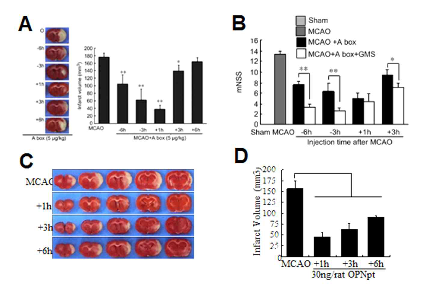 HMGB1 A box (A,B)와 OPN peptide 20 (C,D)의 비강 투여 시기에 따른 뇌경색 억제 효과를 조사함