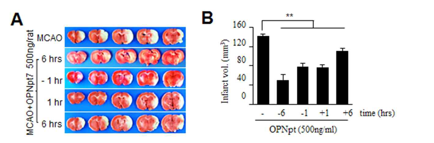 OPN peptide 7의 비강투여 시기에 따른 뇌경색 억제 효과를 조사함