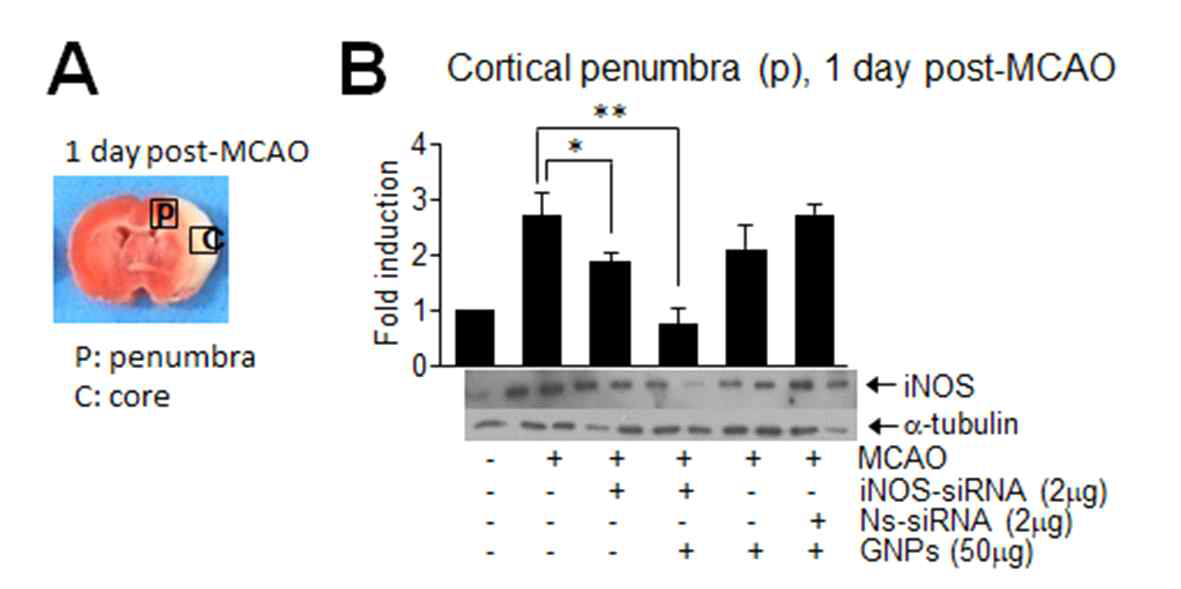 iNOS siRNA를 GNS와 일정비율로 섞어 complex를 만든 후 비강 투여한 후 뇌경색 억제 보호 효과를 조사
