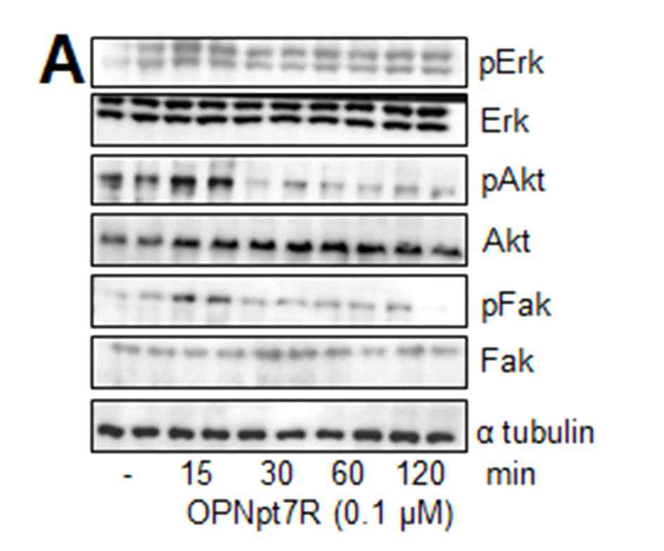 BV2 세포주에 OPN7 펩타이드를 처리한 후, ERK, FAK, AKT 신호전달계 활성화 조사