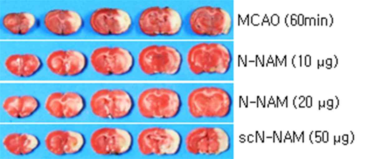 펩타이드 N-NAM을 뇌졸중 동물 모델제작 직 후 비강투여한 후 24시간 경과 후 뇌경색 억제조사