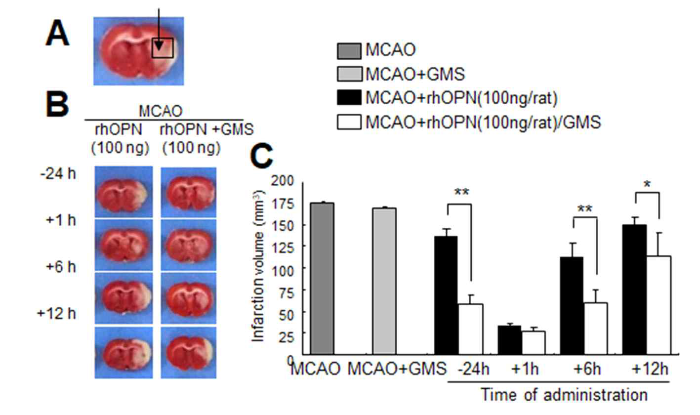 rhOPN을 GMS를 carrier로 사용하여 뇌졸중 동물 모델 제작 –24, +1, +6, +12 시간에 비강투여한 후 뇌경색 억제 효과 조사