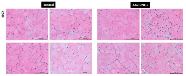 AAV-UNE-L에 의한 20개월령의 TA근육의 영향(H&E staining)