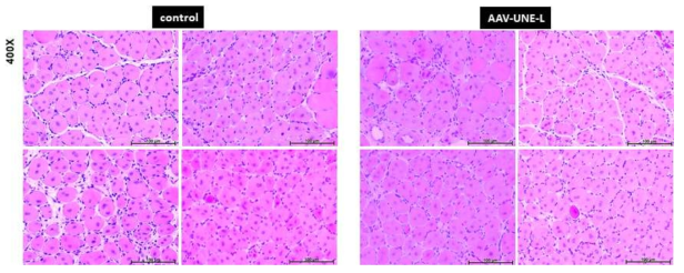 AAV-UNE-L에 의한 10주령의 muscle regeneration 의 영향(H&E staining)