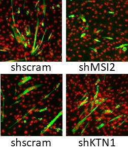 KTN1 혹은 MSI2 knockdown이 근육세포의 분화에 미치는 영향