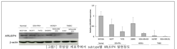 유방암 세포주에서 subtype별 ARL6IP4 발현정도