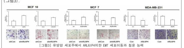 유방암 세포주에서 ARL6IP4의한 EMT 세포이동과 침윤 능력