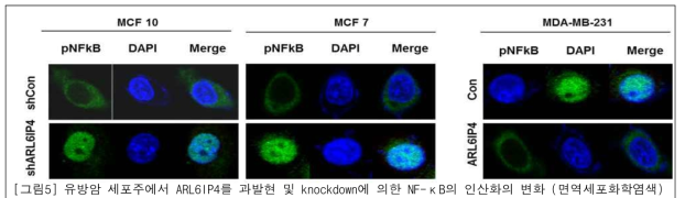 유방암 세포주에서 ARL6IP4를 과발현 및 knockdown에 의한 NF-κB의 인산화의 변화 (면역세포화학염색)