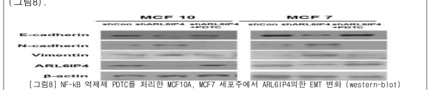 NF-kB 억제제 PDTC를 처리한 MCF10A, MCF7 세포주에서 ARL6IP4의한 EMT 변화 (western-blot)