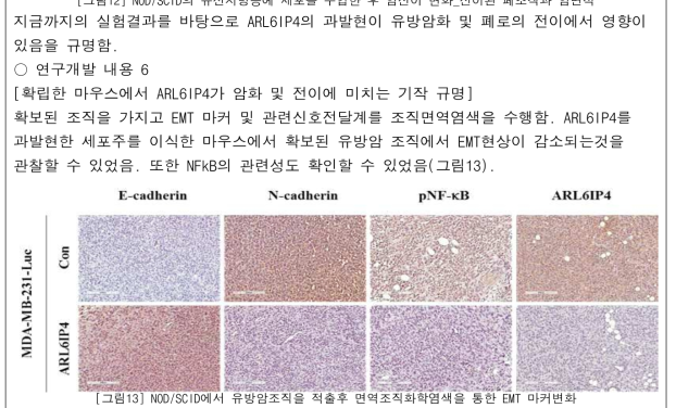 NOD/SCID에서 유방암조직을 적출후 면역조직화학염색을 통한 EMT 마커변화