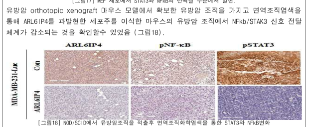 NOD/SCID에서 유방암조직을 적출후 면역조직화학염색을 통한 STAT3와 NFkB변화