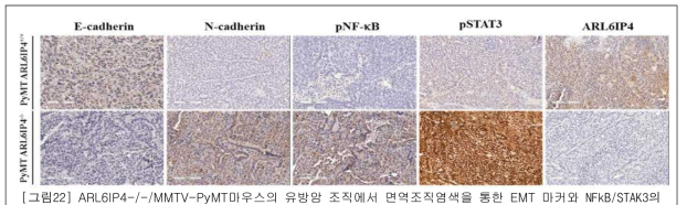 ARL6IP4-/-/MMTV-PyMT마우스의 유방암 조직에서 면역조직염색을 통한 EMT 마커와 NFkB/STAK3의