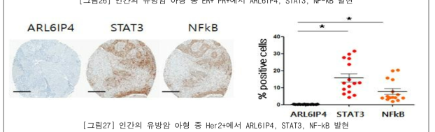 인간의 유방암 아형 중 Her2+에서 ARL6IP4, STAT3, NF-kB 발현