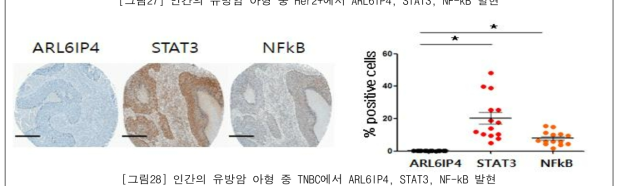 인간의 유방암 아형 중 TNBC에서 ARL6IP4, STAT3, NF-kB 발현