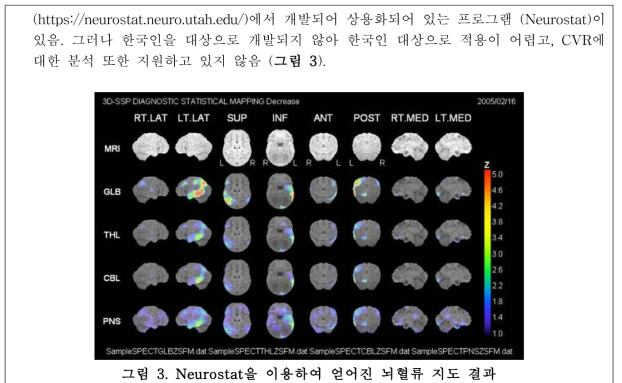Neurostat을 이용하여 얻어진 뇌혈류 지도 결과