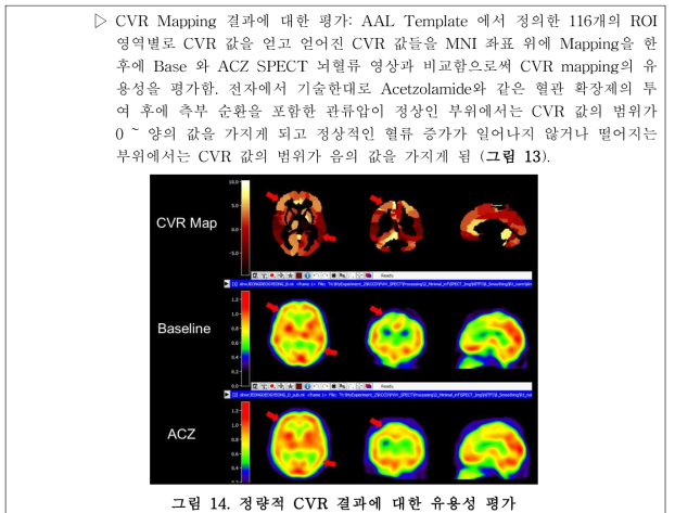 정량적 CVR 결과에 대한 유용성 평가