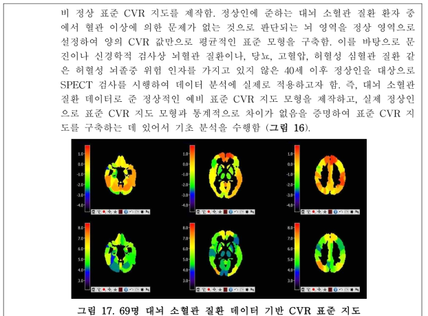 69명 대뇌 소혈관 질환 데이터 기반 CVR 표준 지도
