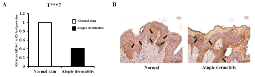 아토피 조직에서 T***7의 mRNA 및 단백질 발현