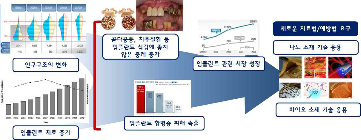 바이오소재 기술을 응용한 임플란트 시장전망