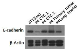 parental CTC1 and CTC2, primary tumor, lung-meta tumor 세포주에서 E-cadherin 발현