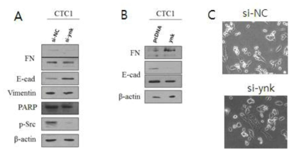 ynk 유전자에 의한 EMT 조절