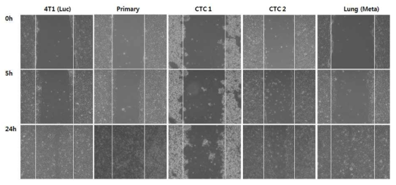 Parental, Primary, CTC1, CTC2, 폐 전이 세포주의 Wound healing ability