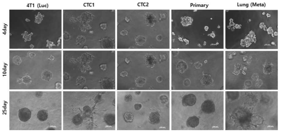 Parental, CTC1, CTC2, Primary와 폐 전이 세포주의 3D culture