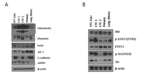 Parental, CTC1, CTC2, Primary와 폐전이 세포주의 EMT 및 세포 성장 관련 분자의 변화