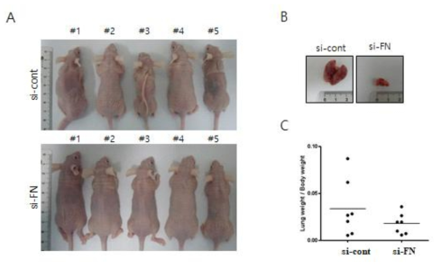 폐암세포를 이용한 FN 발현 저해에 의한 마우스의 폐전이 억제