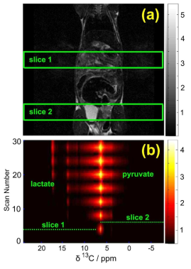 (a) Normal male nude mouse의 coronal image (b) Hyperpolarized 1-13C Pyruvic acid의 Slice-selective Time-resolved image