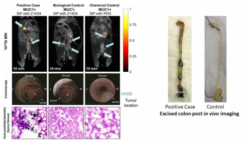 항체 표면기능화-실리콘 나노입자를 사용한 대장암 동물 모델 실험