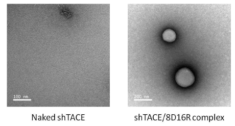 인간 유전자치료제 shTACE/8D16R 중량 비율 4일 때 복합체의 형태를 TEM (Transmission electron microscopy) 사진으로 확인한 결과