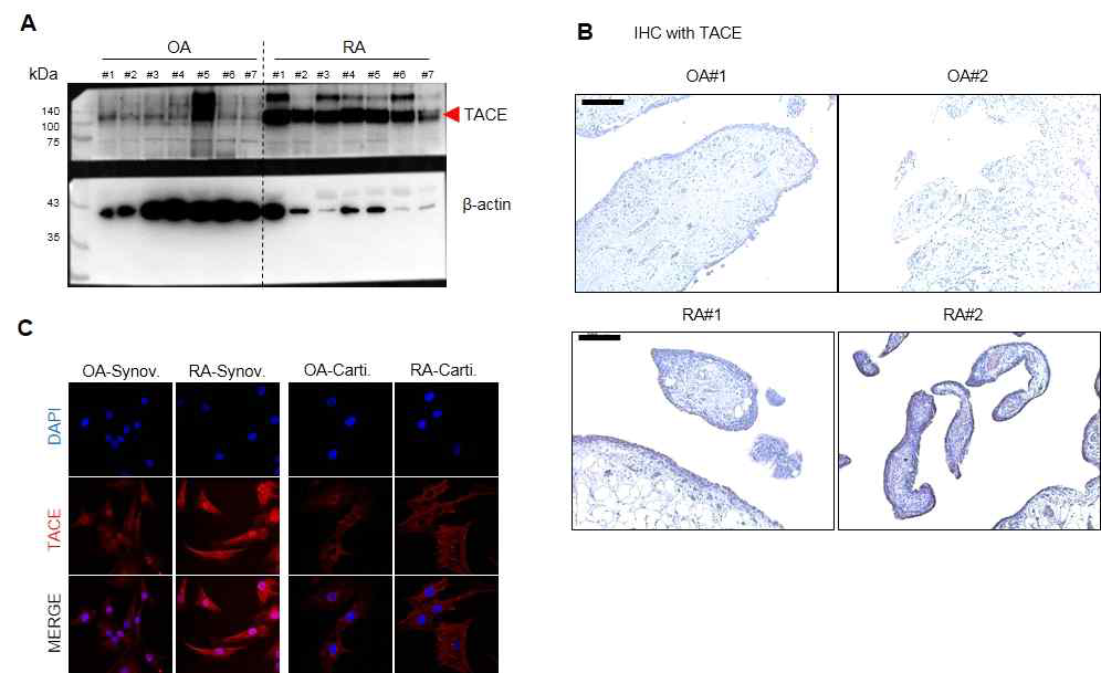 A: 관절액 수집 후 남은 cell pellet에서 TACE 발현을 immunoblot으로 확인함 B: OA와 RA 환자의 Synovium 조직에서 TACE 발현을 IHC로 확인함. C: OA와 RA 환자의 Synovium과 Cartilage에서 분리된 세포를 면역염색으로 TACE 발현을 확인함