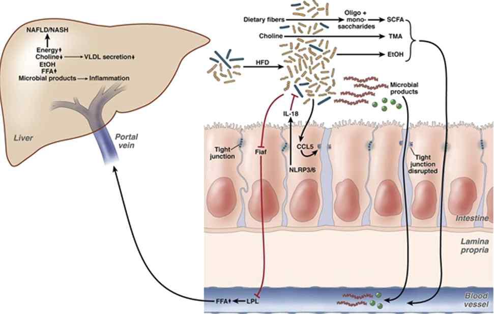 비알코올 지방간 질환에서의 장내 마이크로비옴의 작용 기전