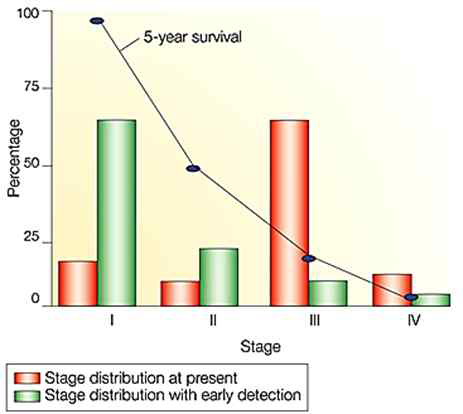 난소암 5년 생존율 분석을 통한 조기 진단의 중요성
