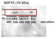 난소암 세포주 유래 엑소좀 내 HSP70 단백질의 발현