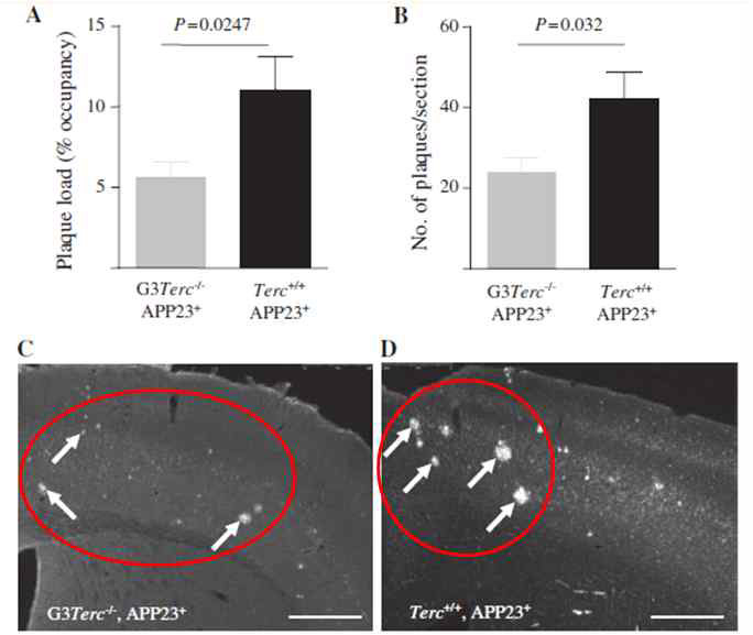 텔로미어 조절과 알츠하이머병에서 amyloid plaque 생성 효과 연구