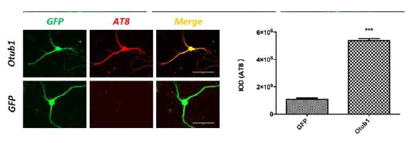 도파민성 뉴련에서 Otub1에 의한 Tau의 신경계 분화의 억제효과의 dereregulation 효과 확인