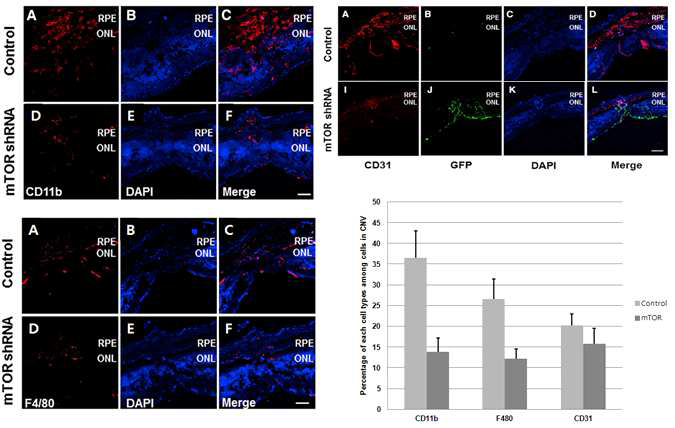 AAV-mTOR shRNA 치료군과 비치료군 맥락막 신생혈관조직에서 단핵구세포, 대식세포, 혈관내피세포군의 전체세포수에 대한 분포 변화